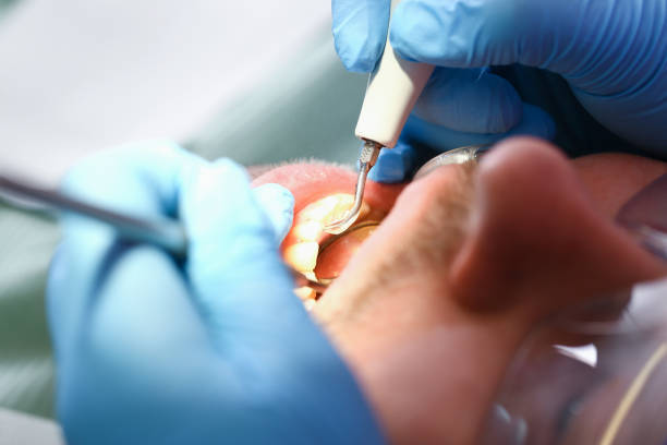 Best Emergency Dental Surgery in French Mp, CA