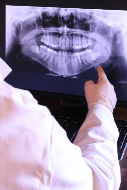 Best Emergency Broken Tooth Repair in French Mp, CA