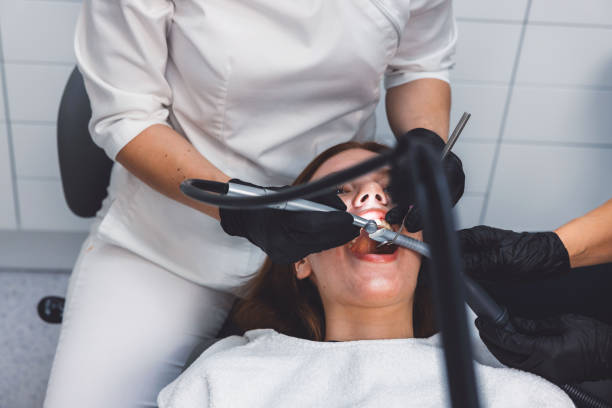 Best Emergency Wisdom Teeth Removal in French Mp, CA